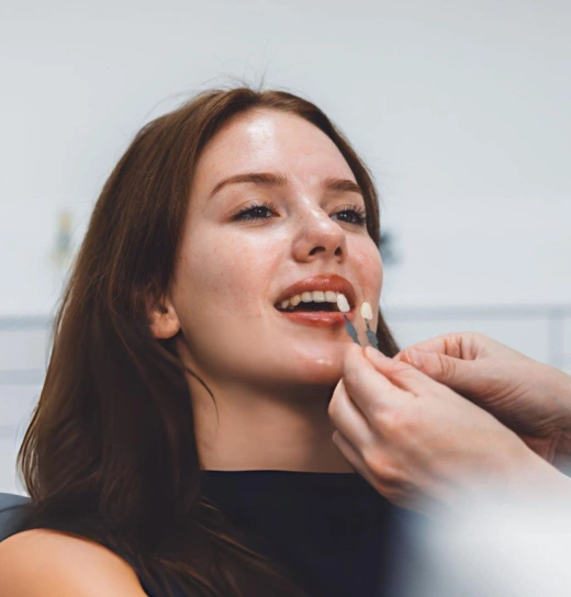 veneers